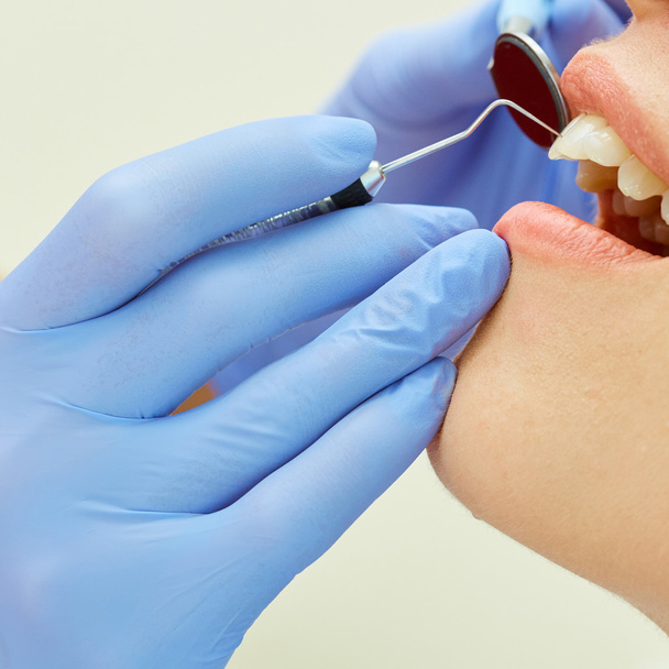 Examining teeth - Foto, Imagem