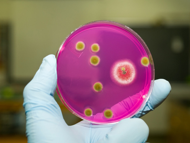 Mikrobiologie - Foto, Bild
