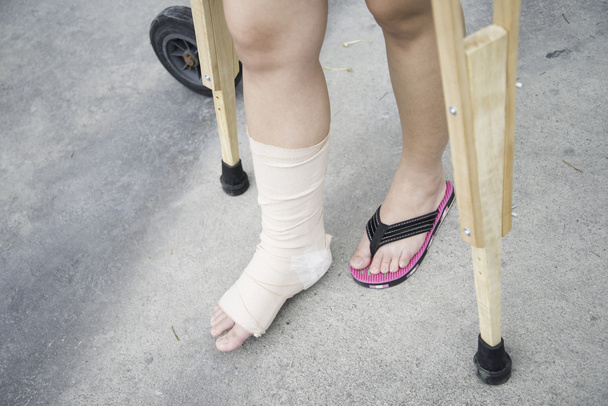 Detail left leg or in white plaster placed and crutch.Broken leg in  plaster. The boy has a broken ankle. Stock Photo
