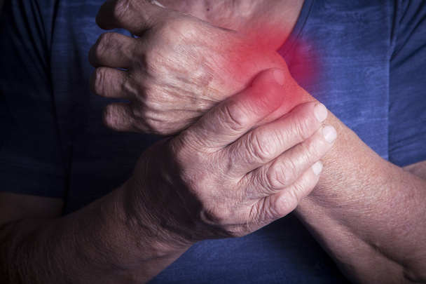 Hand Deformed From Rheumatoid Arthritis - Foto, Imagen