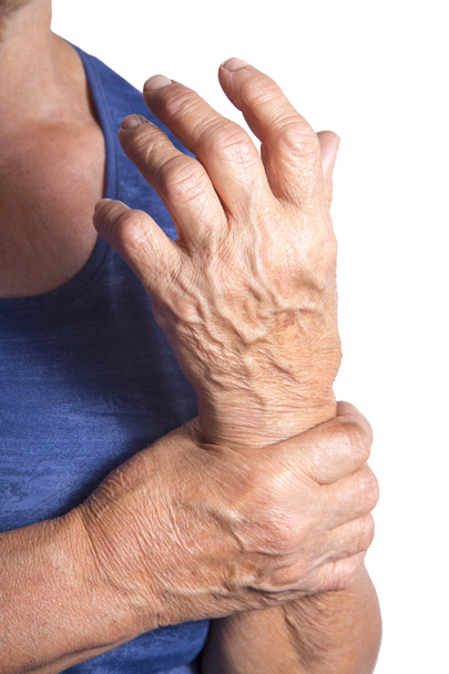 Hand Deformed From Rheumatoid Arthritis - Foto, afbeelding