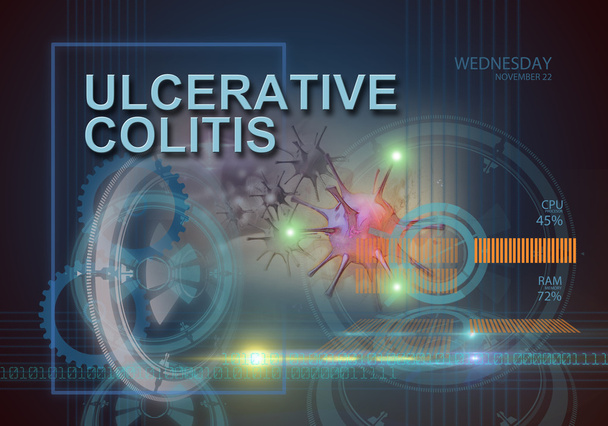 Colitis ulcerosa - Foto, afbeelding