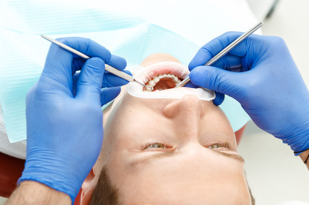 Dental checkup of the pacient - Φωτογραφία, εικόνα