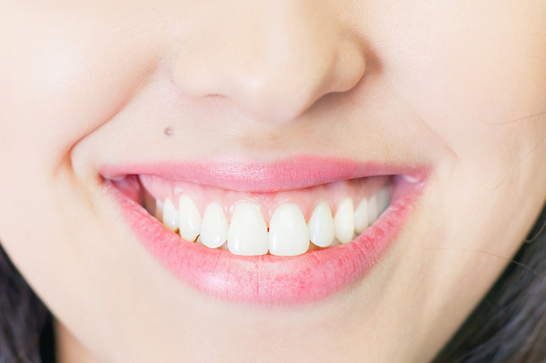 Hermosa sonrisa de mujer con dientes sanos blanqueamiento
 - Foto, imagen