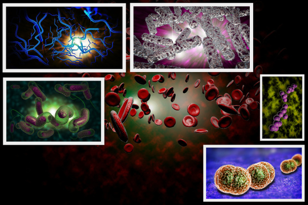 Bacteriën infectie Collage - Foto, afbeelding