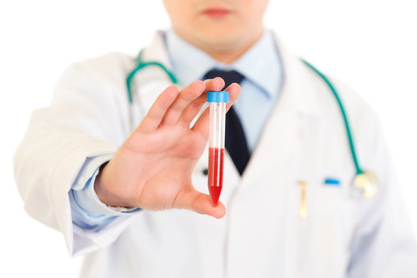 Medical doctor holding blood sample in hand. Close-up. - Zdjęcie, obraz