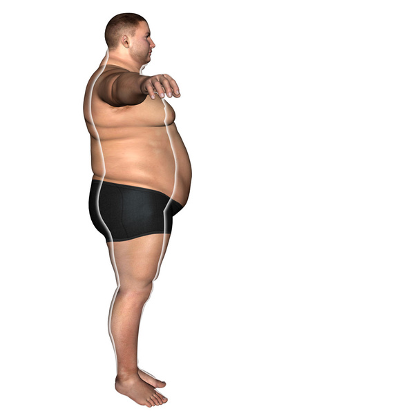rasva ylipainoinen tai ohut sovi ruokavalio
 - Valokuva, kuva