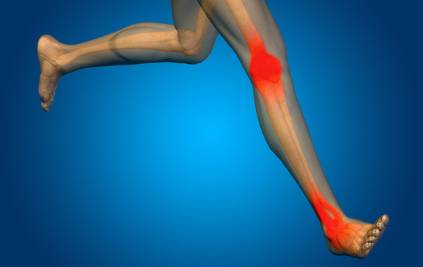 joint or articular pain, ache - Photo, Image
