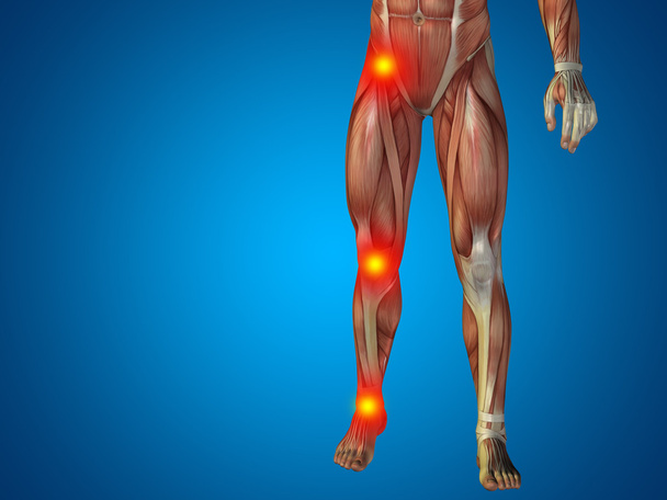joint or articular pain, ache or injury - Photo, Image