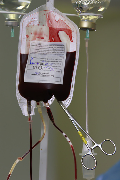 Blood transfusion - Photo, image