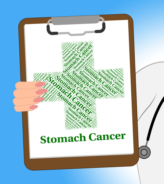 El cáncer de estómago muestra enfermedades y aflicciones
 - Foto, imagen