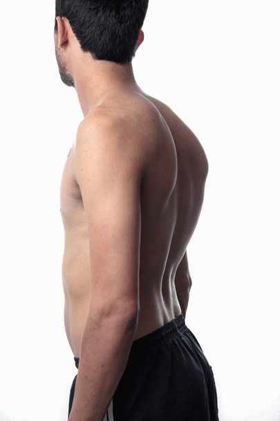 scoliosis, thin man on his back, no shirt. curvature of the spin - Foto, immagini