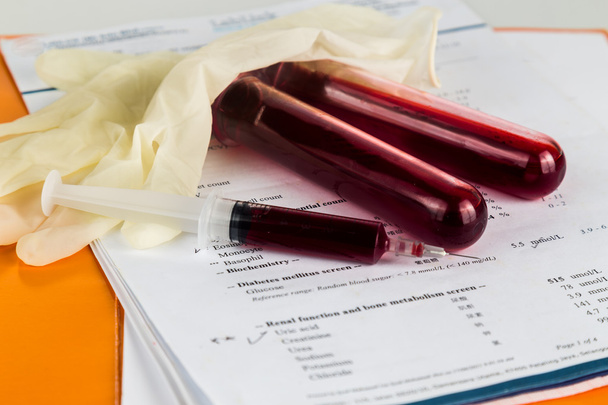 Campione di sangue in provette con rapporto sullo screening dello stato di salute
 - Foto, immagini