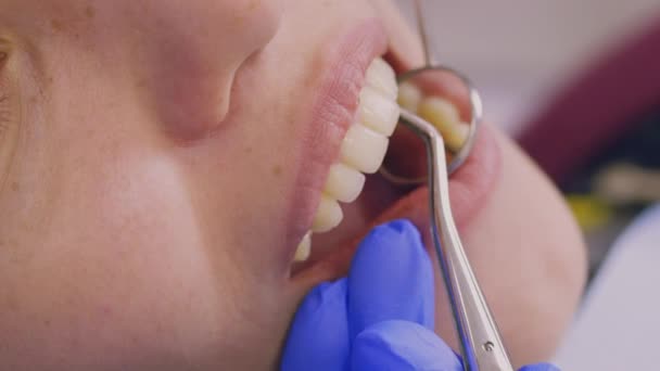 Εξέταση των δοντιών σε κοντινό πλάνο - Πλάνα, βίντεο