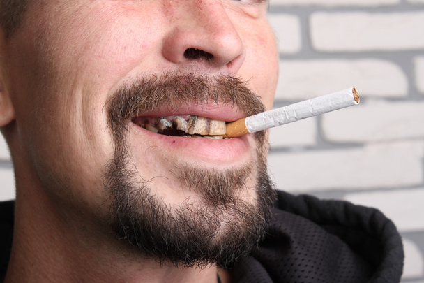 Bad teeth smoker sick - Photo, Image