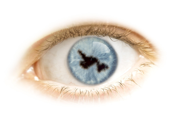 Gros plan d'un œil avec la pupille en forme de Terre-Neuve
.( - Photo, image