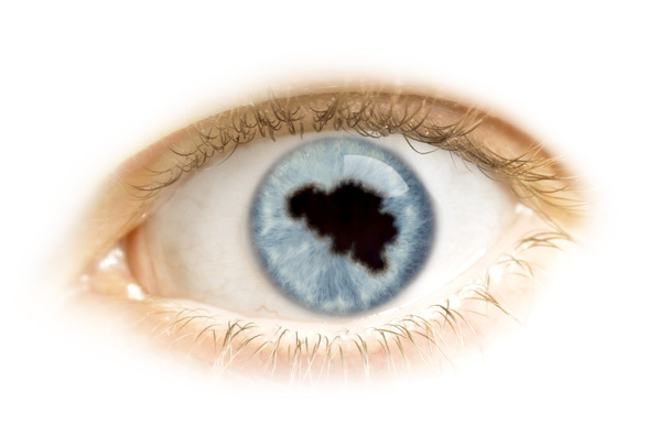 Primer plano de un ojo con la pupila en forma de Bélgica. (serie
 - Foto, Imagen
