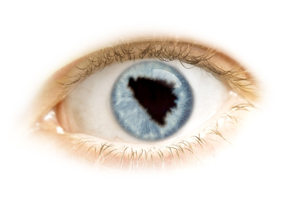 Gros plan d'un œil avec la pupille en forme de Bosnie-Herzégovine
 - Photo, image