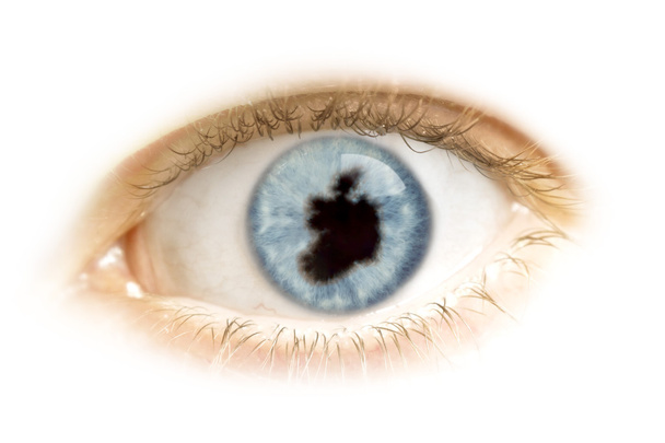 Close-up of an eye with the pupil in the shape of Ireland.(serie - 写真・画像