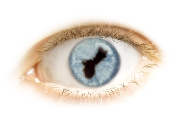 Close-up de um olho com o aluno na forma de Guam. (série
) - Foto, Imagem