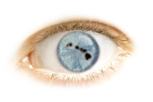 Крупный план глаза со зрачком в форме Гавайев. (серия
 - Фото, изображение