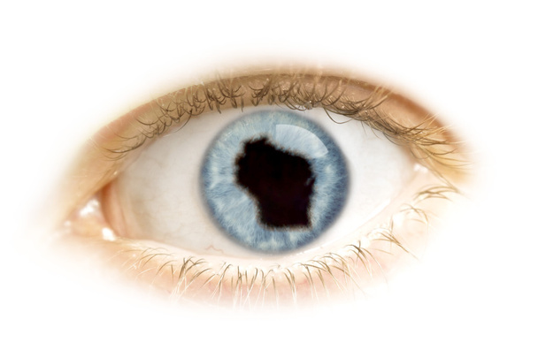 Крупный план глаза с зрачком в форме Висконсина. (ser
 - Фото, изображение