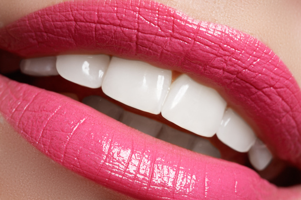 Perfect smile before and after bleaching. Dental care and whitening teeth. Smile with white healthy teeth. Healthy woman teeth and smile and sexy full pink lips - Fotografie, Obrázek