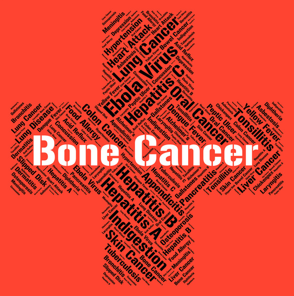 Рак кости представляет плохое здоровье и недуги
 - Фото, изображение