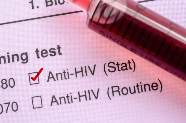 Red correct check mark with blood sample for HIV test. - Photo, image