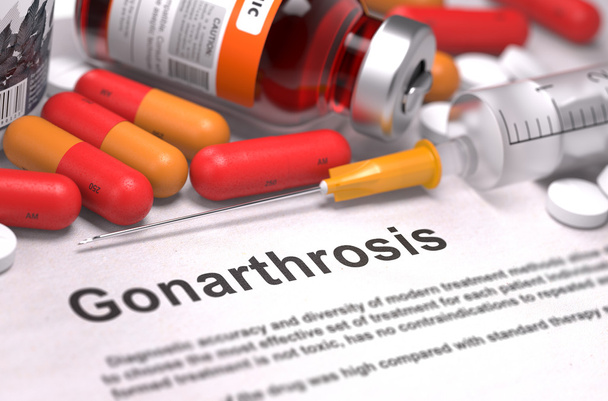 Gonarthrosis Diagnosis. Medical Concept. - 写真・画像