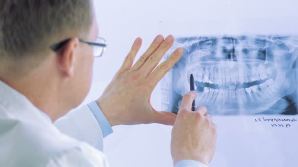 Doctor checking X-Ray - Video, Çekim