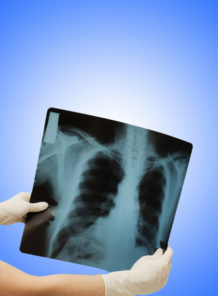 Две руки, держащие рентгеновское изображение человеческого тела
 - Фото, изображение