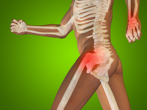 Kavramsal 3d insan anatomi veya sağlık tasarım, ortak ya da eklem ağrısı, ağrı ya da yaralanma yeşil degrade arka plan üzerinde - Fotoğraf, Görsel