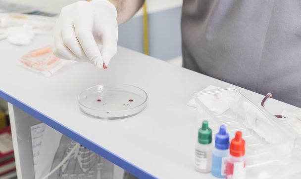 Hände des Arztes bei der Analyse und eine Blutprobe an einem Tisch mit Handschuhen - Foto, Bild