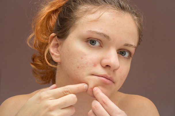 retrato de joven hermosa mujer apretando acné o espinilla isola
 - Foto, Imagen