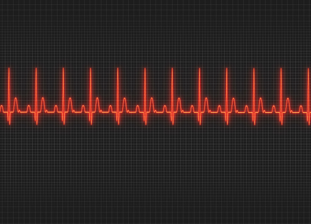 egy EKG illusztráció, a háttér sötét képernyő - Fotó, kép
