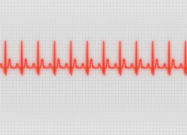 une illustration d'électrocardiographie en fond d'écran lumineux
 - Photo, image
