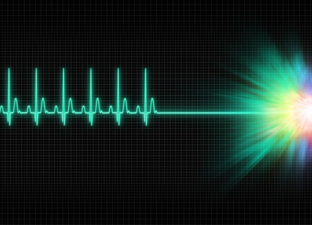 una ilustración del exitus de la electrocardiografía mística en fondo oscuro de la pantalla
 - Foto, Imagen