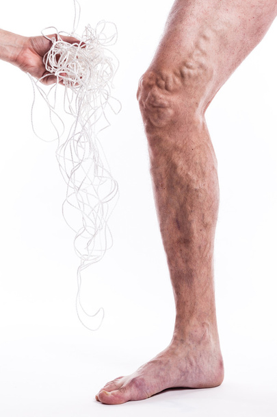 um emaranhado de cordas com um homem doente com varizes de th
 - Foto, Imagem