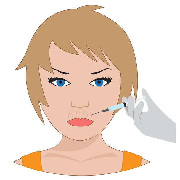 surgery of lips wrinkles - Vector, Image