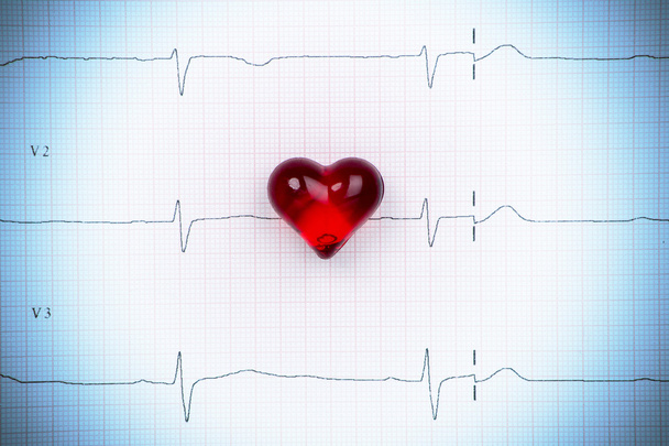 Schema cardiaco dell'elettrocardiogramma
 - Foto, immagini