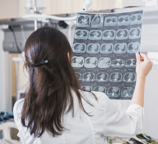 piękna dziewczyna lekarz w biały płaszcz analizuje zdjęcie rentgenowskie pacjenta, aby zidentyfikować problem. Zawodowe rozmowy, konsultacje lekarzy. Prace konferencji. - Zdjęcie, obraz