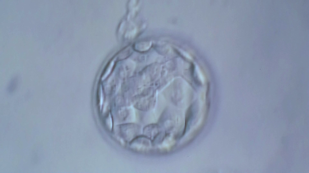 Podział komórek in vitro płód pod mikroskopem. Rodzajowy komórki dzielące. - Materiał filmowy, wideo