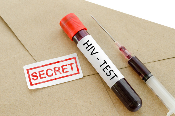Secret result diagnosis HIV test concept. - Photo, image