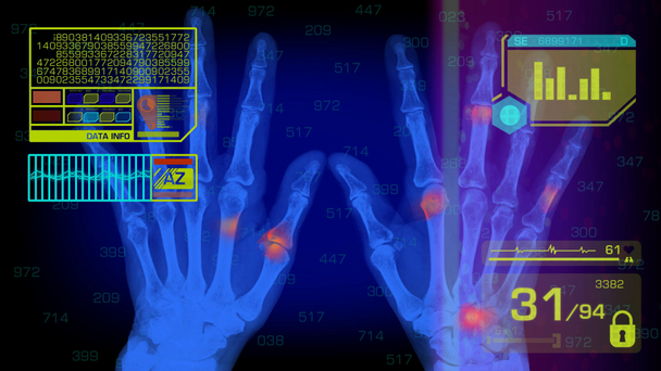 Hands Analysis - Graphics - Yellow - Footage, Video