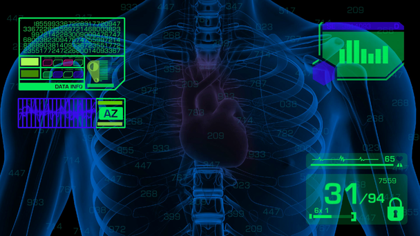Ανάλυση - γραφικών - πράσινη καρδιά - Πλάνα, βίντεο