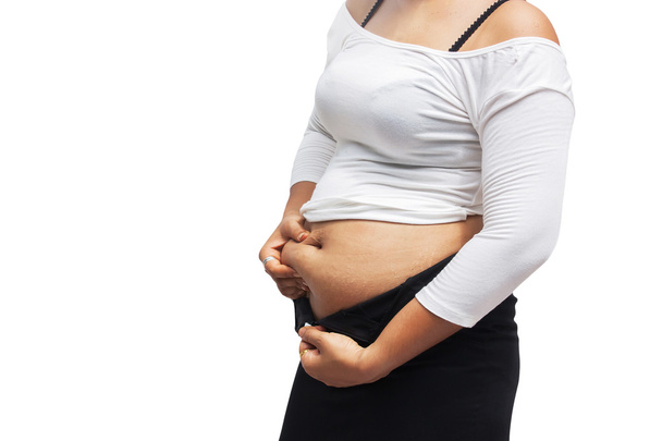kehon naiset rasvaa vatsa ja Stretch Mark
 - Valokuva, kuva