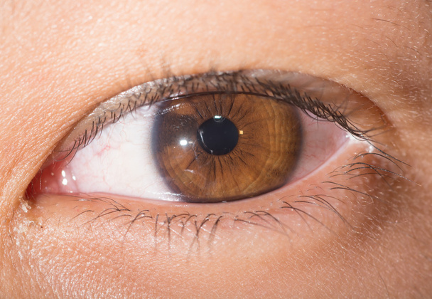 視力検査で虹彩母斑 - 写真・画像
