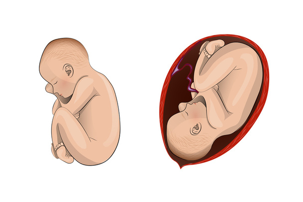 Schwangere. Kind - Vektor, Bild