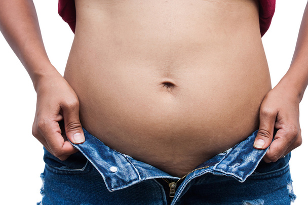 Femmes avec gros ventre et vergetures, face avant
 - Photo, image